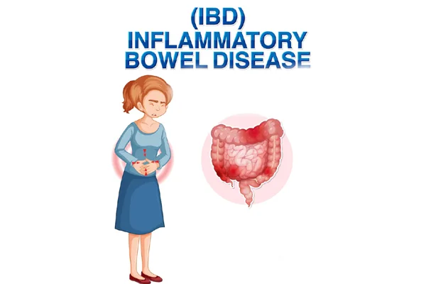 IBD
