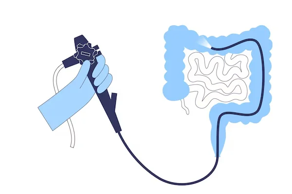 Colonoscopy